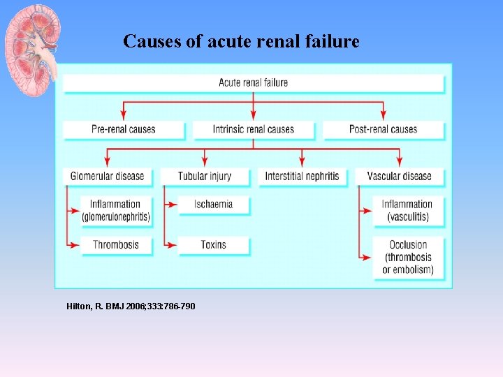 Causes of acute renal failure Hilton, R. BMJ 2006; 333: 786 -790 