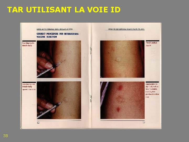 TAR UTILISANT LA VOIE ID 38 