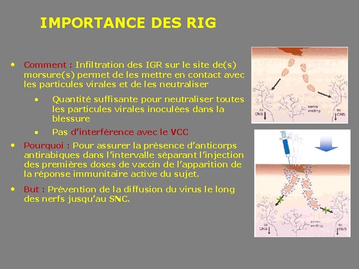 IMPORTANCE DES RIG • Comment : Infiltration des IGR sur le site de(s) morsure(s)