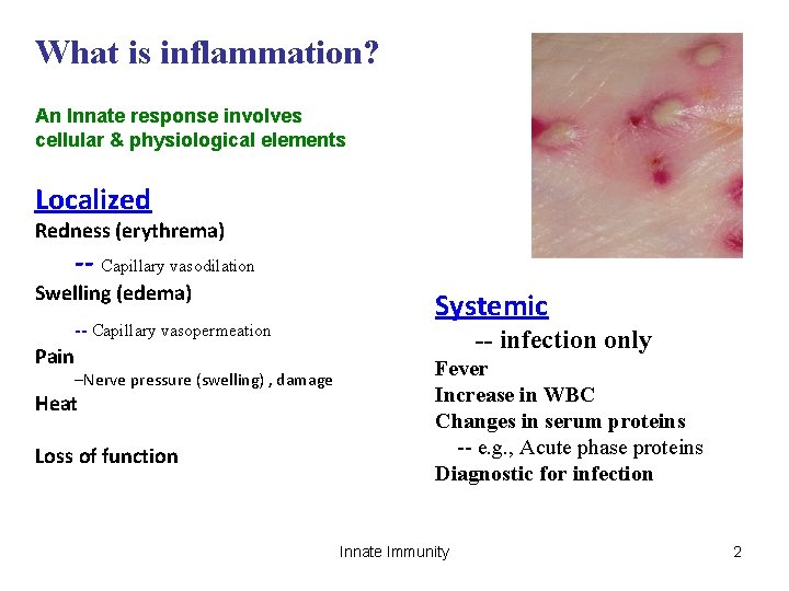 What is inflammation? An Innate response involves cellular & physiological elements Localized Redness (erythrema)