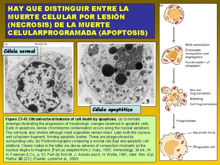 HAY QUE DISTINGUIR ENTRE LA MUERTE CELULAR POR LESIÓN (NECROSIS) DE LA MUERTE CELULARPROGRAMADA