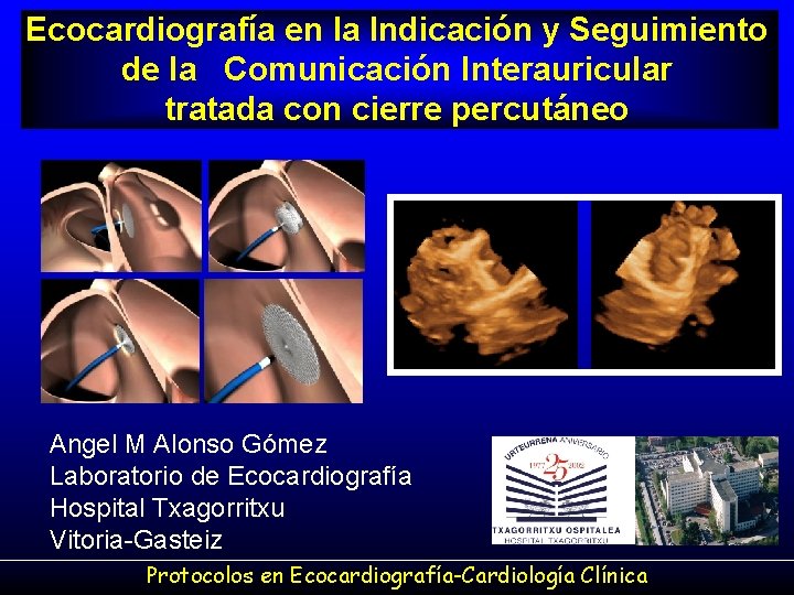 Ecocardiografía en la Indicación y Seguimiento de la Comunicación Interauricular tratada con cierre percutáneo