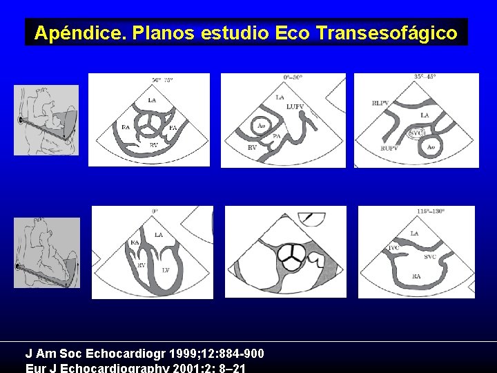 Apéndice. Planos estudio Eco Transesofágico J Am Soc Echocardiogr 1999; 12: 884 -900 