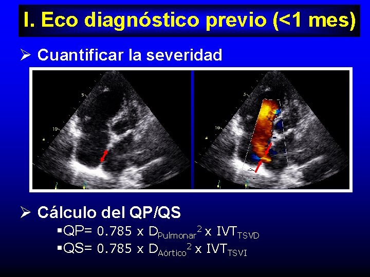 I. Eco diagnóstico previo (<1 mes) Ø Cuantificar la severidad Ø Cálculo del QP/QS