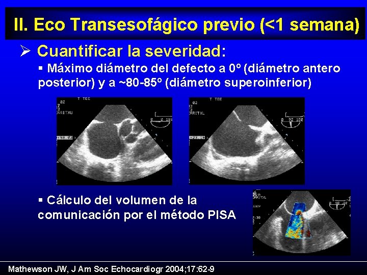 II. Eco Transesofágico previo (<1 semana) Ø Cuantificar la severidad: § Máximo diámetro del