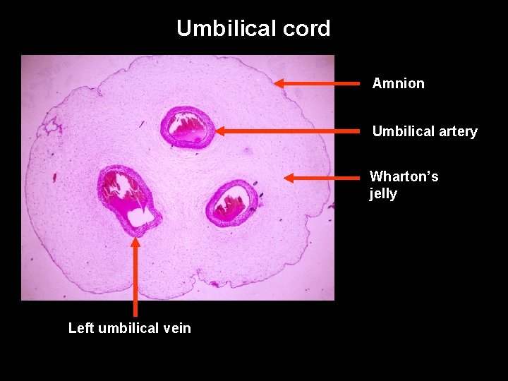 Umbilical cord Amnion Umbilical artery Wharton’s jelly Left umbilical vein Umbilical cord Amnion Umbilical artery Wharton’s jelly Left umbilical vein