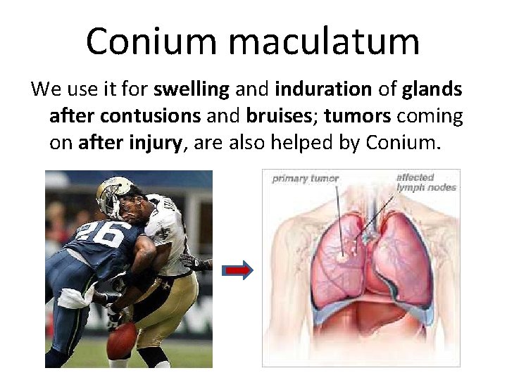 Conium maculatum We use it for swelling and induration of glands after contusions and