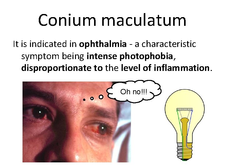 Conium maculatum It is indicated in ophthalmia - a characteristic symptom being intense photophobia,