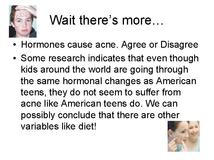 Wait there’s more… • Hormones cause acne. Agree or Disagree • Some research indicates
