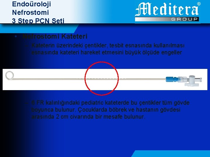 Endoüroloji Nefrostomi 3 Step PCN Seti • Nefrostomi Kateteri – Kateterin üzerindeki çentikler, tesbit