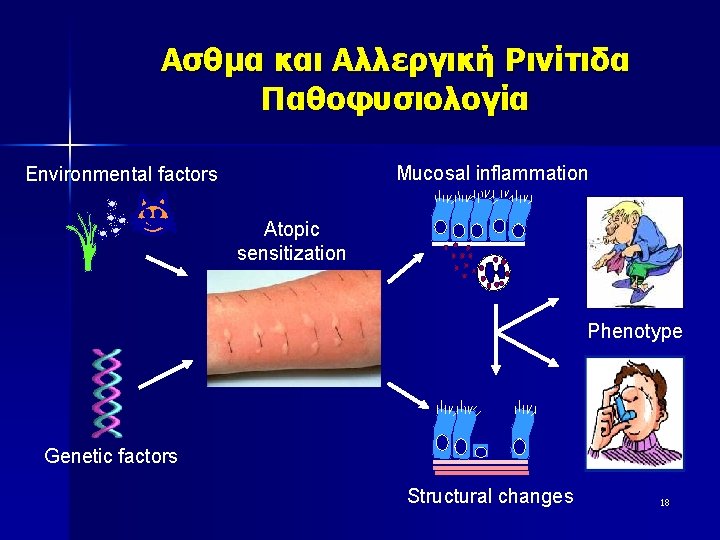 Ασθμα και Αλλεργική Ρινίτιδα Παθοφυσιολογία Mucosal inflammation Environmental factors Atopic sensitization Phenotype Genetic factors