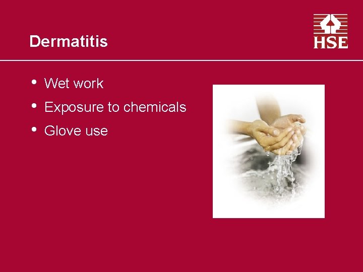 Dermatitis • • • Wet work Exposure to chemicals Glove use 