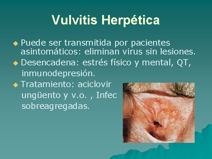 Vulvitis Herpética Puede ser transmitida por pacientes asintomáticos: eliminan virus sin lesiones. u Desencadena: