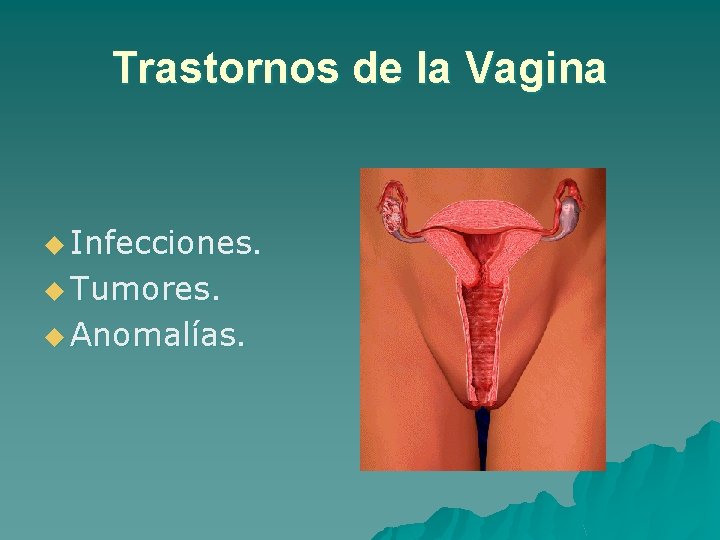 Trastornos de la Vagina u Infecciones. u Tumores. u Anomalías. 