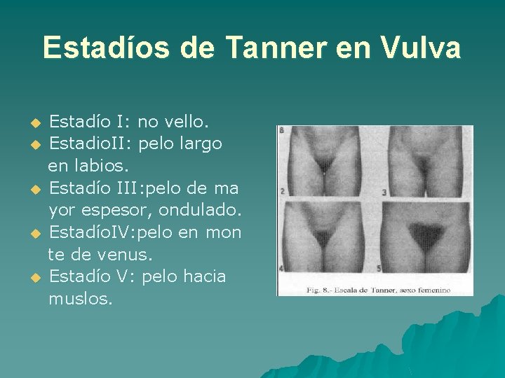 Estadíos de Tanner en Vulva u u u Estadío I: no vello. Estadio. II: