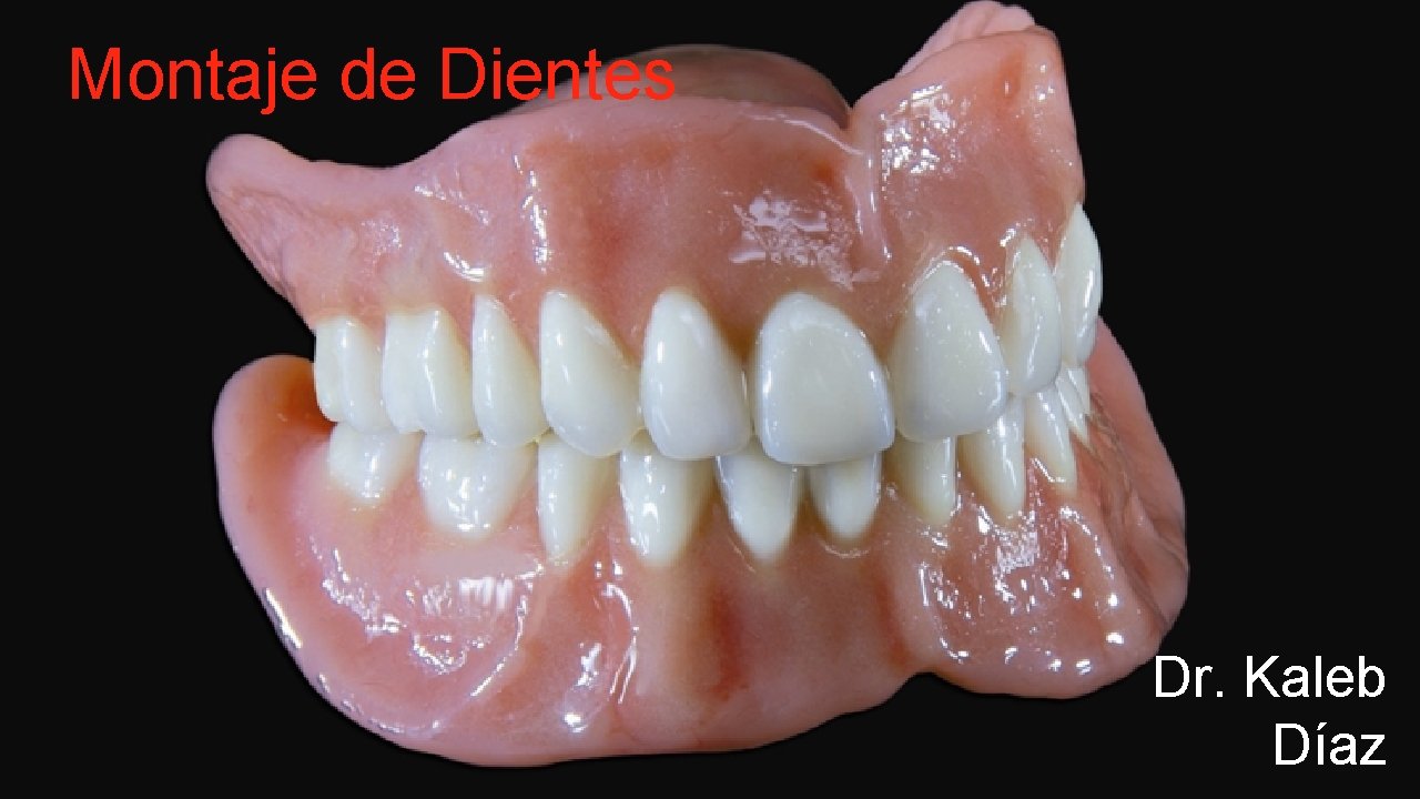 Montaje de Dientes Dr. Kaleb Díaz 