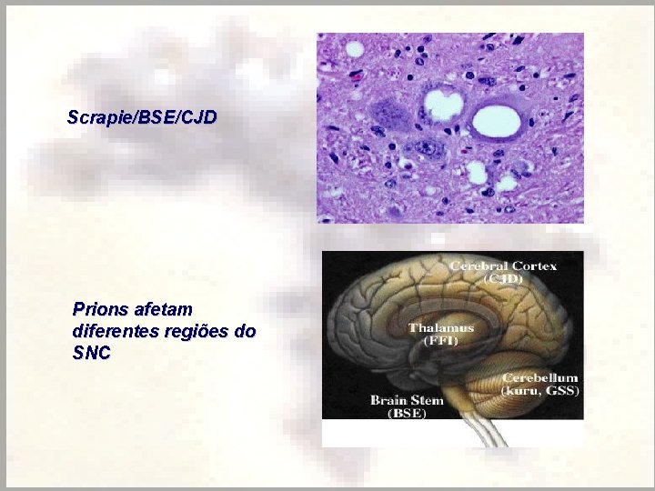 Scrapie/BSE/CJD Prions afetam diferentes regiões do SNC 