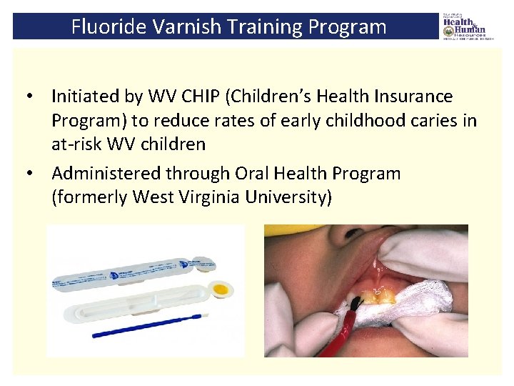 Fluoride Varnish Training Program • Initiated by WV CHIP (Children’s Health Insurance Program) to