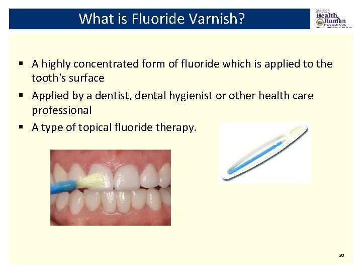 What is Fluoride Varnish? § A highly concentrated form of fluoride which is applied