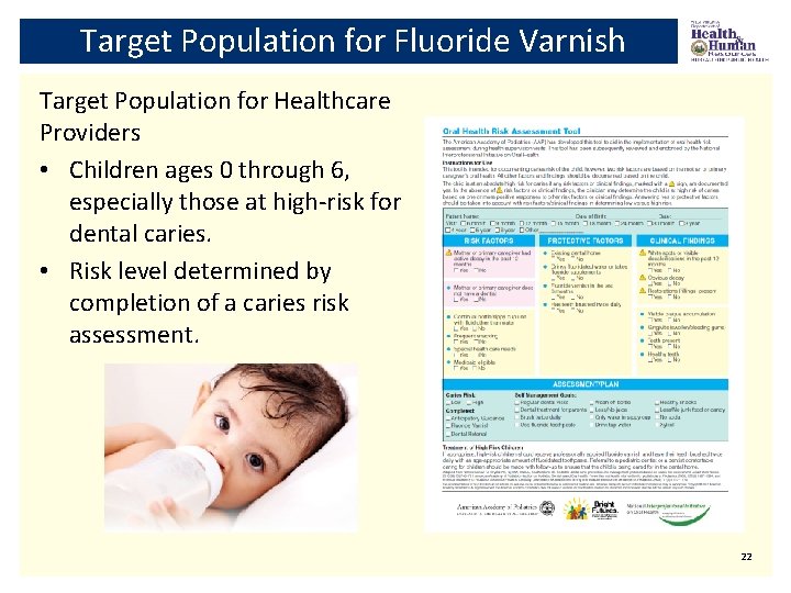 Target Population for Fluoride Varnish Target Population for Healthcare Providers • Children ages 0