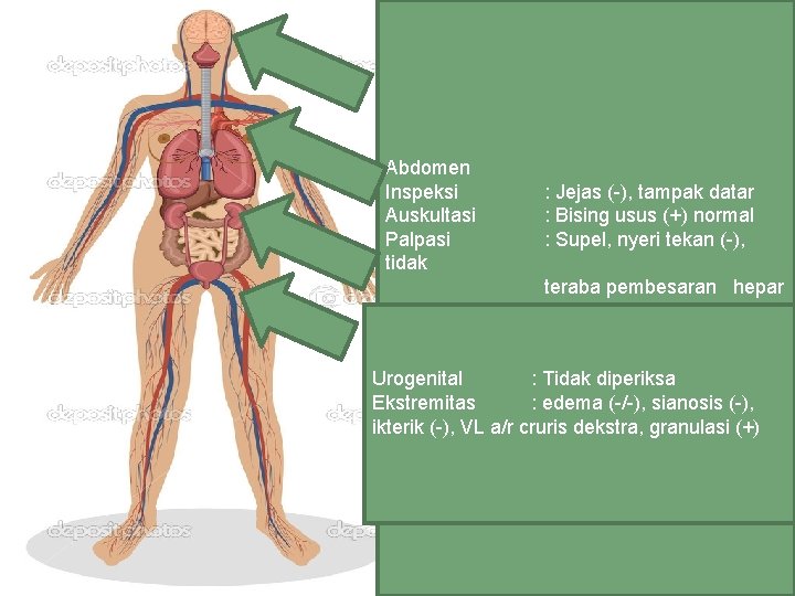 Status Generalis Kes : CM GCS E 4 V 5 M 6 Kepala :