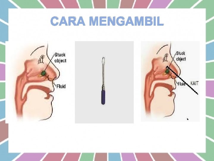 CARA MENGAMBIL 