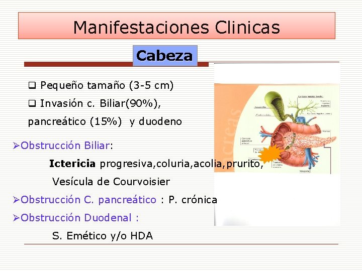 Manifestaciones Clinicas Cabeza q Pequeño tamaño (3 -5 cm) q Invasión c. Biliar(90%), pancreático