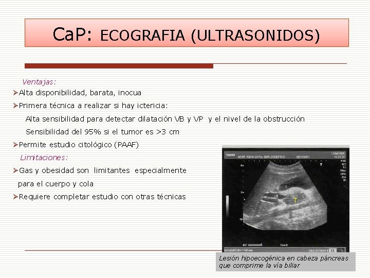 Ca. P: ECOGRAFIA (ULTRASONIDOS) Ventajas: ØAlta disponibilidad, barata, inocua ØPrimera técnica a realizar si