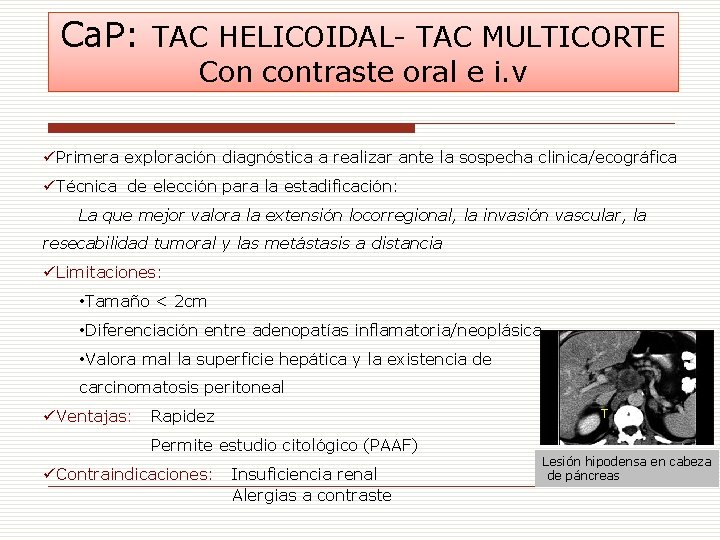 Ca. P: TAC HELICOIDAL- TAC MULTICORTE Con contraste oral e i. v üPrimera exploración