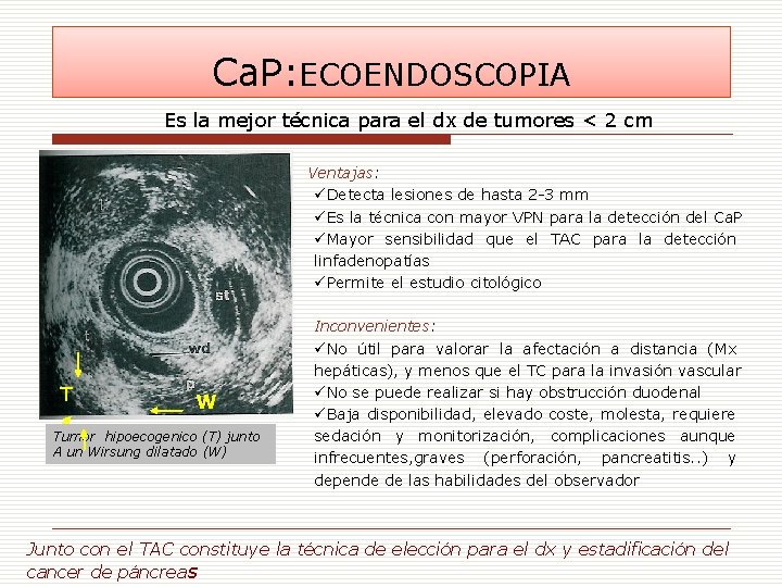 Ca. P: ECOENDOSCOPIA Es la mejor técnica para el dx de tumores < 2