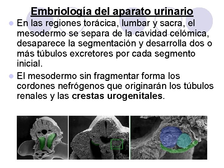 Embriología del aparato urinario En las regiones torácica, lumbar y sacra, el mesodermo se