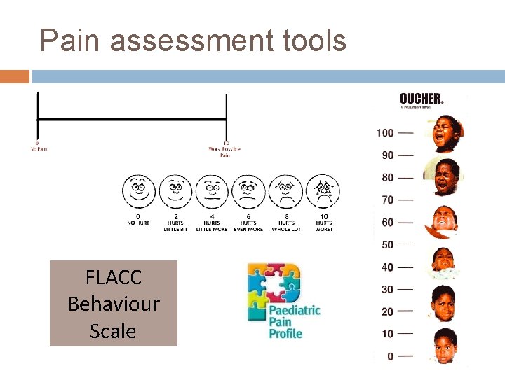 Pain assessment tools FLACC Behaviour Scale 
