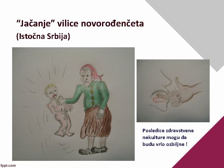 “Jačanje” vilice novorođenčeta (Istočna Srbija) Posledice zdravstvene nekulture mogu da budu vrlo ozbiljne !