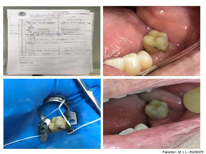 Paciente I. M. J. L. - RG 038279 Paciente I. M. J. L. - RG 038279