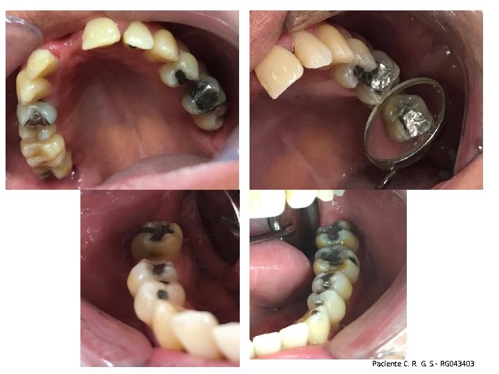 Paciente C. R. G. S. - RG 043403 