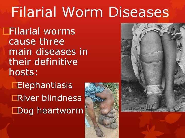 Filarial Worm Diseases �Filarial worms cause three main diseases in their definitive hosts: �Elephantiasis