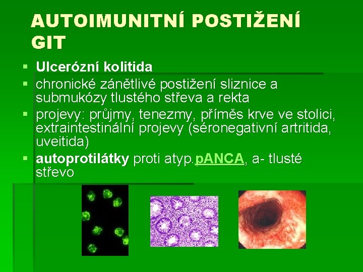 AUTOIMUNITNÍ POSTIŽENÍ GIT § Ulcerózní kolitida § chronické zánětlivé postižení sliznice a submukózy tlustého