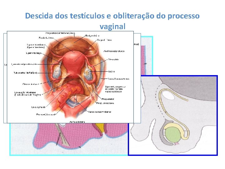 Descida dos testículos e obliteração do processo vaginal GÔNADA GUBERNÁCULO 