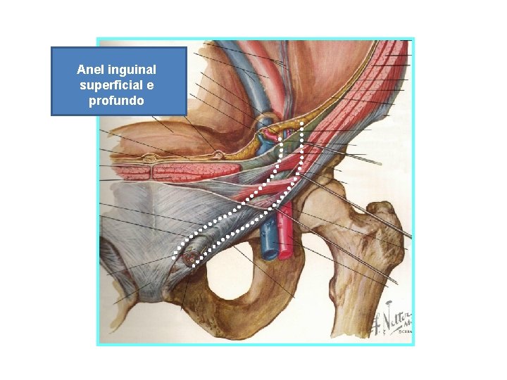 Anel inguinal Teto superficial e profundo 
