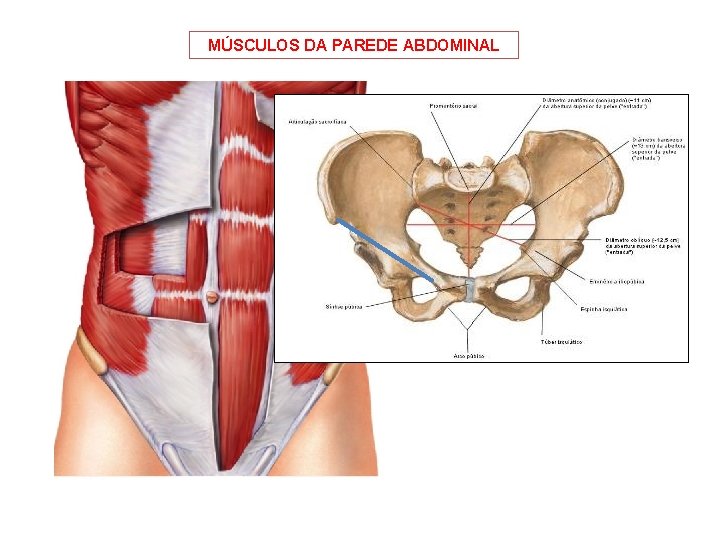 MÚSCULOS DA PAREDE ABDOMINAL 