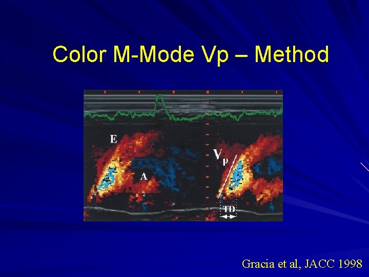 Color M-Mode Vp – Method Gracia et al, JACC 1998 