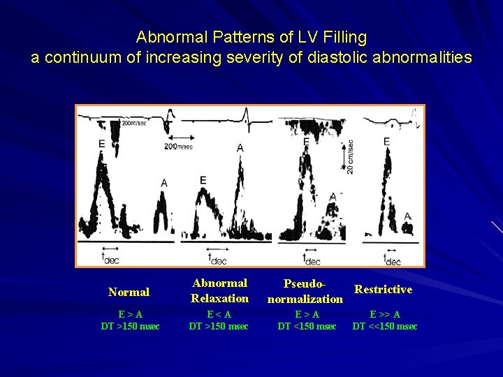 Abnormal Patterns of LV Filling a continuum of increasing severity of diastolic abnormalities Normal