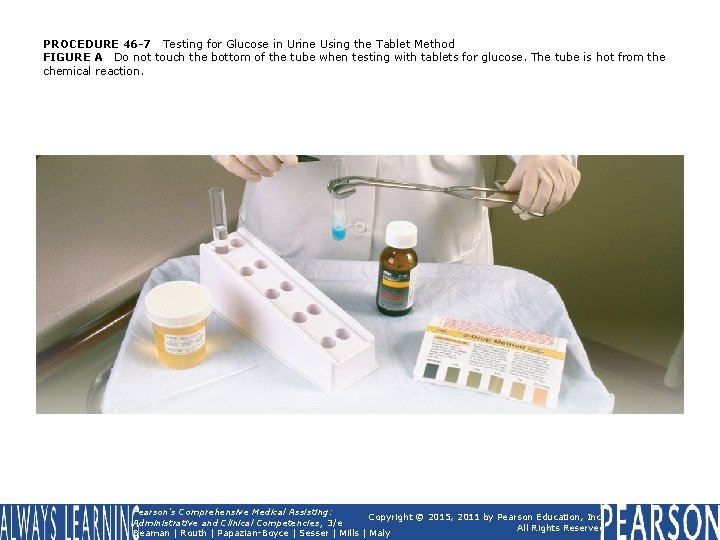 PROCEDURE 46 -7 Testing for Glucose in Urine Using the Tablet Method FIGURE A