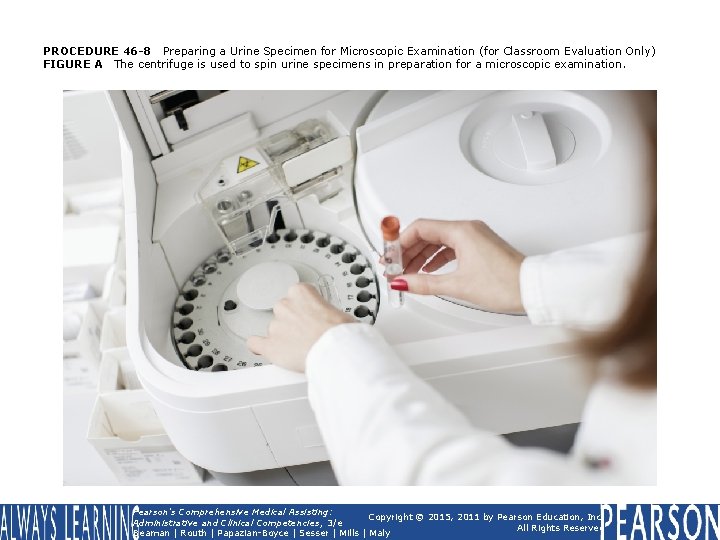 PROCEDURE 46 -8 Preparing a Urine Specimen for Microscopic Examination (for Classroom Evaluation Only)