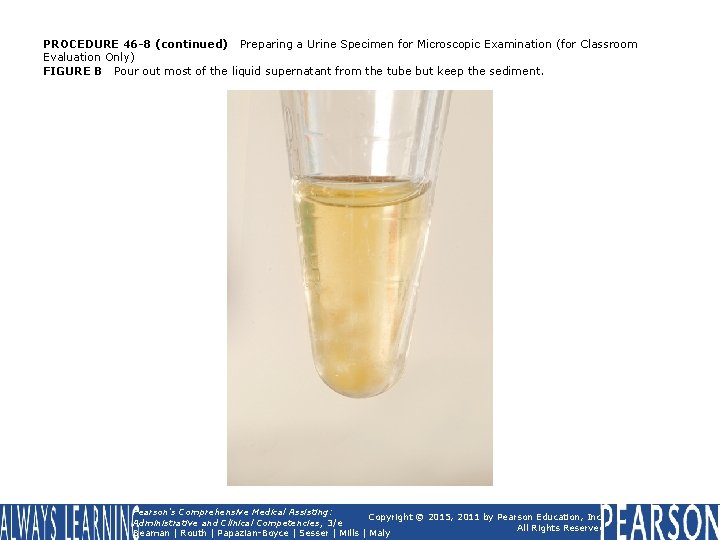 PROCEDURE 46 -8 (continued) Preparing a Urine Specimen for Microscopic Examination (for Classroom Evaluation