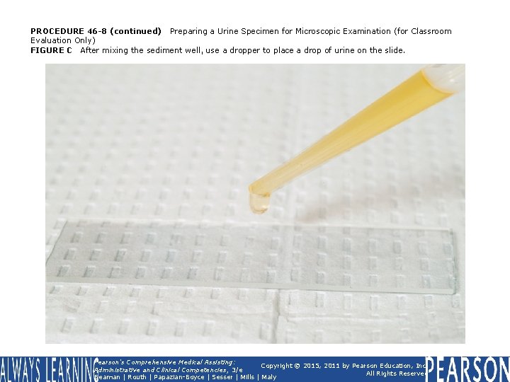 PROCEDURE 46 -8 (continued) Preparing a Urine Specimen for Microscopic Examination (for Classroom Evaluation