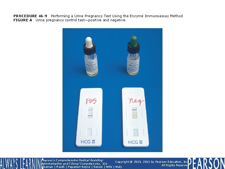 PROCEDURE 46 -9 Performing a Urine Pregnancy Test Using the Enzyme Immunoassay Method FIGURE