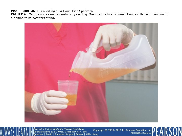 PROCEDURE 46 -1 Collecting a 24 -Hour Urine Specimen FIGURE A Mix the urine