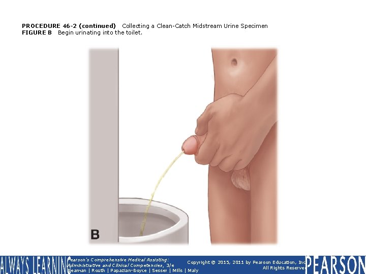 PROCEDURE 46 -2 (continued) Collecting a Clean-Catch Midstream Urine Specimen FIGURE B Begin urinating