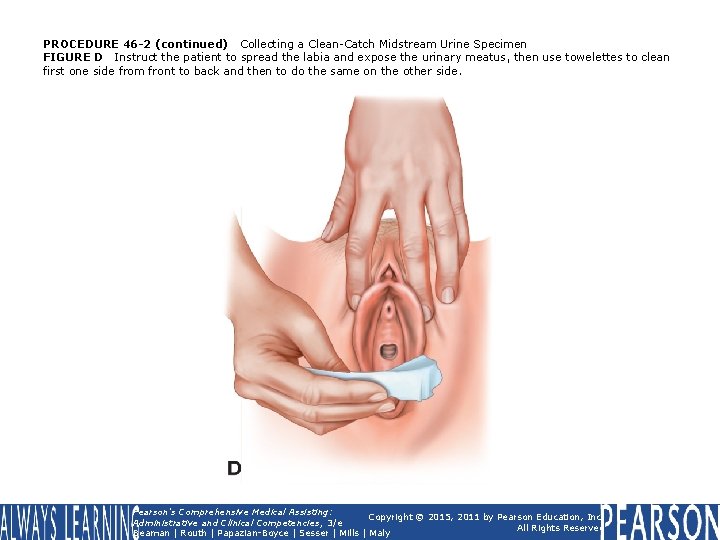 PROCEDURE 46 -2 (continued) Collecting a Clean-Catch Midstream Urine Specimen FIGURE D Instruct the